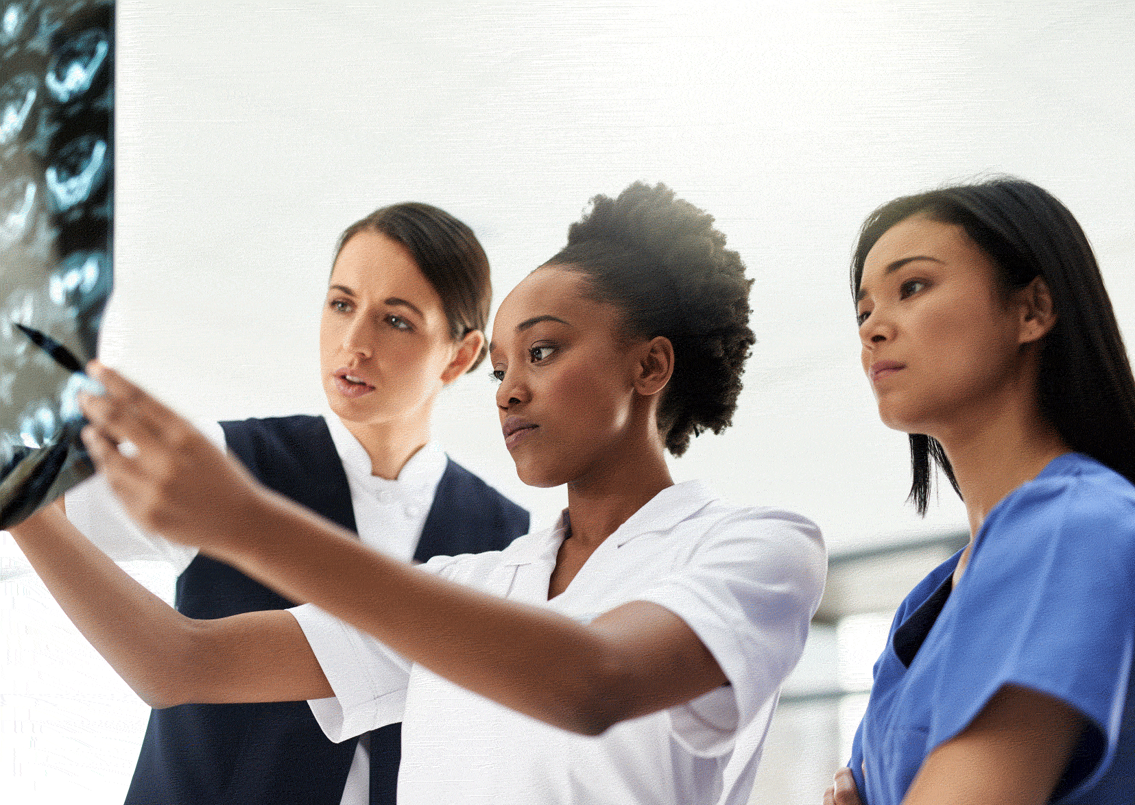 Three women nurses looking at an MRI scan